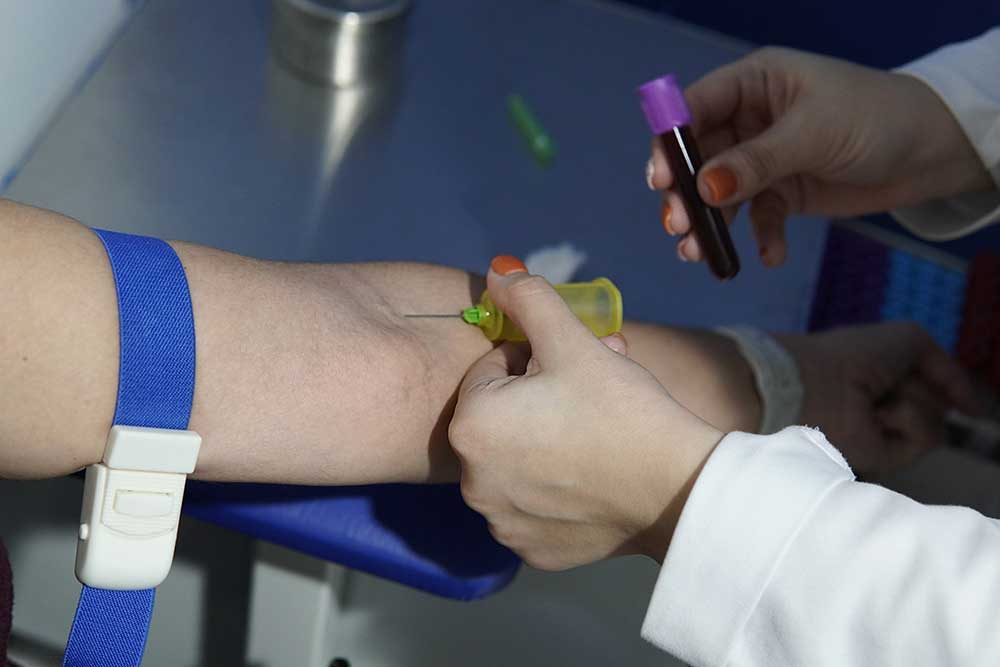 당화혈색소(HbA1c) 검사, 무엇이고 왜 중요할까? 완벽 가이드